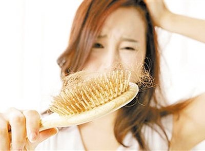 如何预防脱发 女性经常脱发怎么治呢?