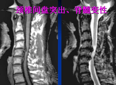 如何保护脊柱健康呢 我们需要怎么做